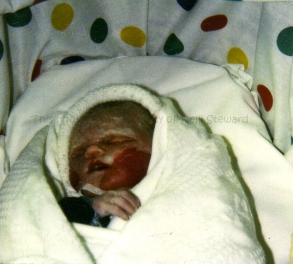 Lottie-Jette's Little Life